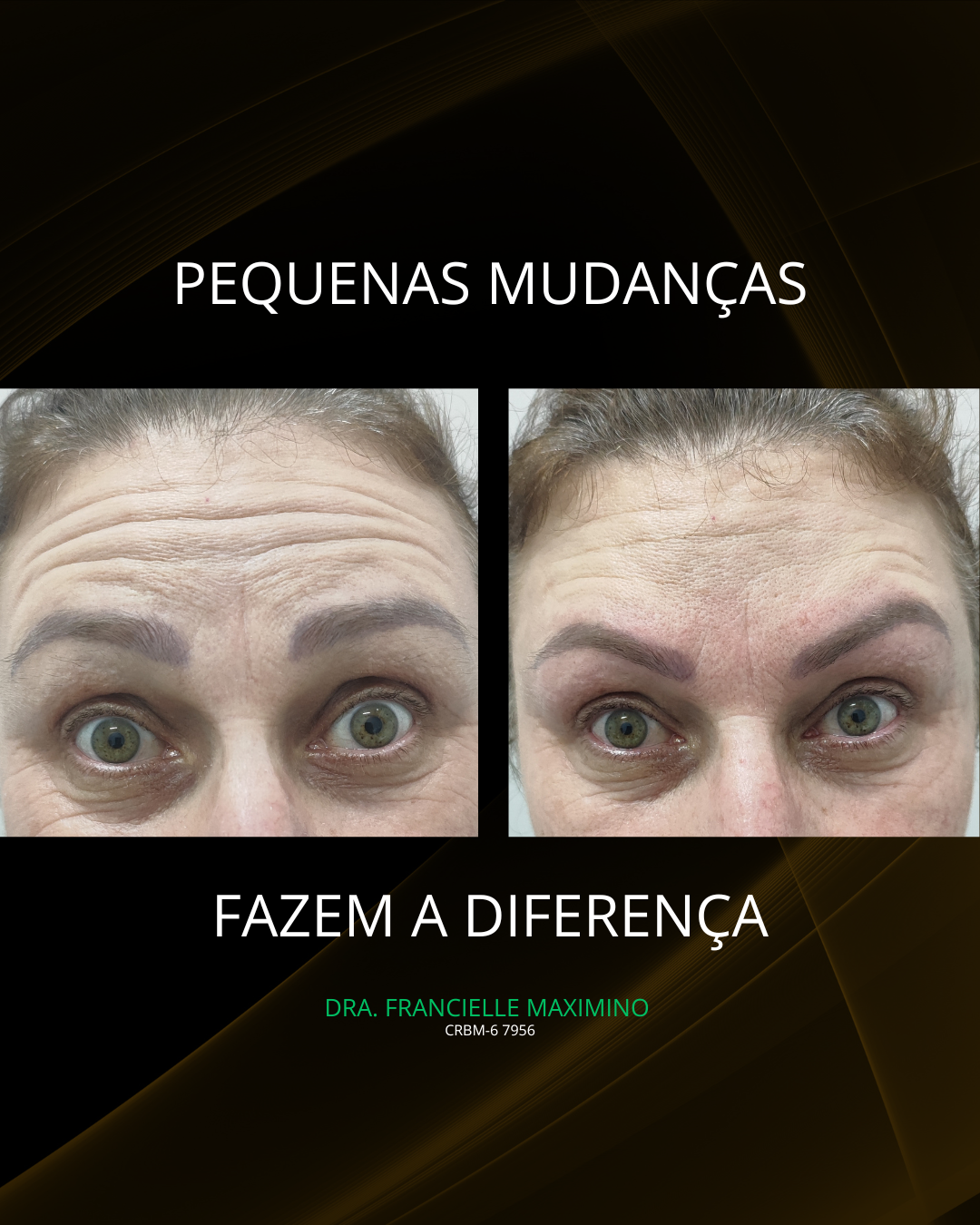 Tatamento Facial